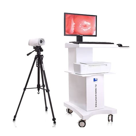 Medical Equipment Hd Video Colposcope Vaginal Camera For Vagina Exam China Video Colposcope