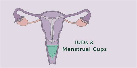 Can I Use A Menstrual Cup With An Iud Period Nirvana