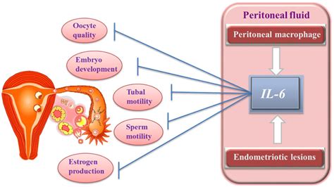 Clinical Management Of Endometriosis‐associated Infertility Khine