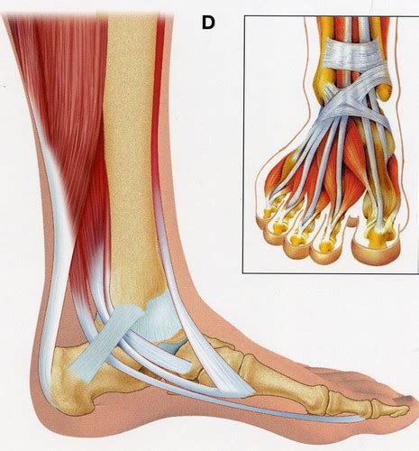 Bande élastique, plâtre, botte de marche ou attelle jambière post. Blog 75: Infos santé-Entorse