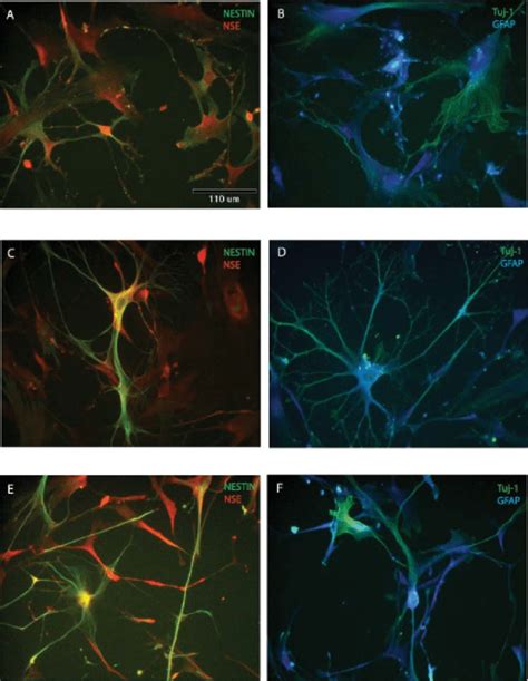 Expression Of Neural Stem Cell And Neuroblast Markers In Mouse Adas