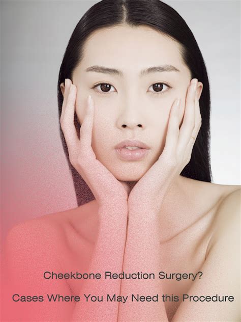 Eyelid Surgery Legend Dr Kim Byung Gun Bk Plastic Surgery Hosptial