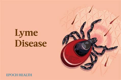 The Essential Guide To Lyme Disease Symptoms Causes Treatments And