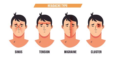 Types Of Headaches Chart Cervicogenic Headache Physiopedia It Is Not