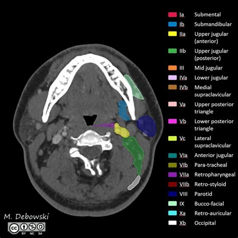 Head And Neck Ct Scan Of Neck Lymph Nodes
