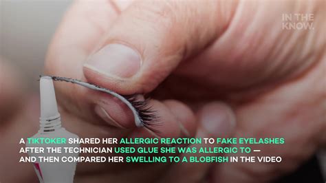 Woman Shares Allergic Reaction To Eyelash Extensions