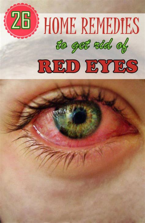 Home Remedy Hacks • 26 Effective Home Remedies To Get Rid Of Red Eyes