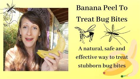 Banana Peel To Treat Bug Bites Youtube