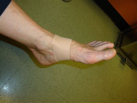 Foot And Ankle Problems By Dr Richard Blake Kinesiotape Advice From