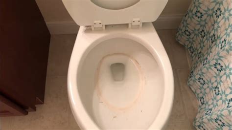 Can A Dirty Bathroom Make You Sick