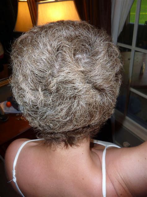 Anncredible Hair Growth Progression After Chemo Six Months With UPDATE