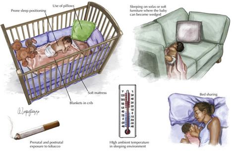 Apparent Life Threatening Event And Sudden Infant Death Syndrome