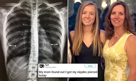 Mom Discovers Daughters Secret Nipple Piercings When A Doctor Inadvertently Reveals Them In X