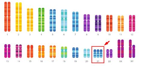 Chromosome Aneuploidies Xcelom