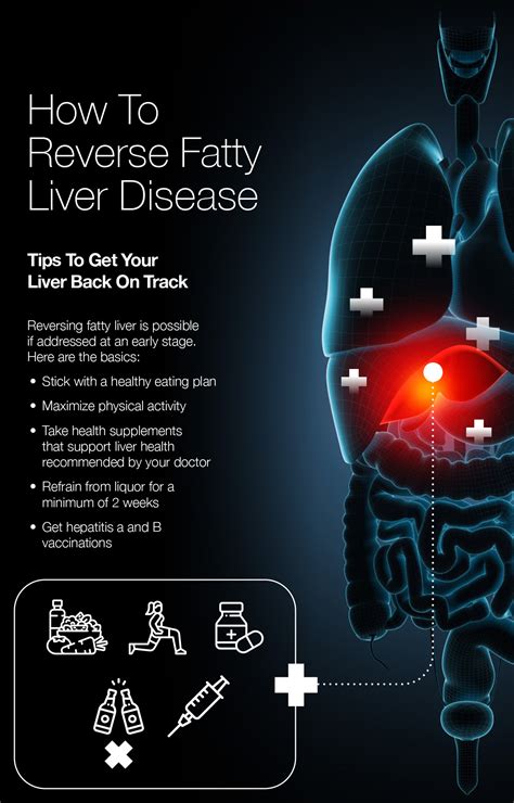 reversing fatty liver disease nafld and afld fattyliverdisease