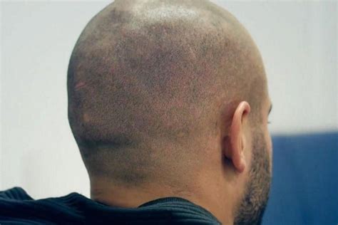#PoolLandscaping | Hair tattoos, Hair loss bald, Bald heads