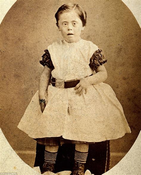 Photos Of Disabled People In The Victorian Era Daily Mail Online