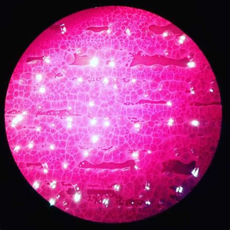 Through The Microscope Gram Negative Rods Mix Endo Agar