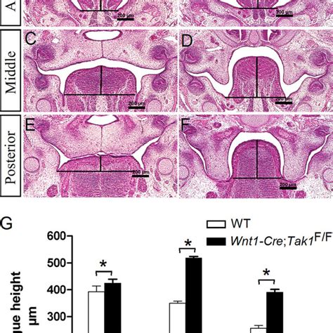 Normal Palate Development In Mice Lacking Tak1 In Either Palatal