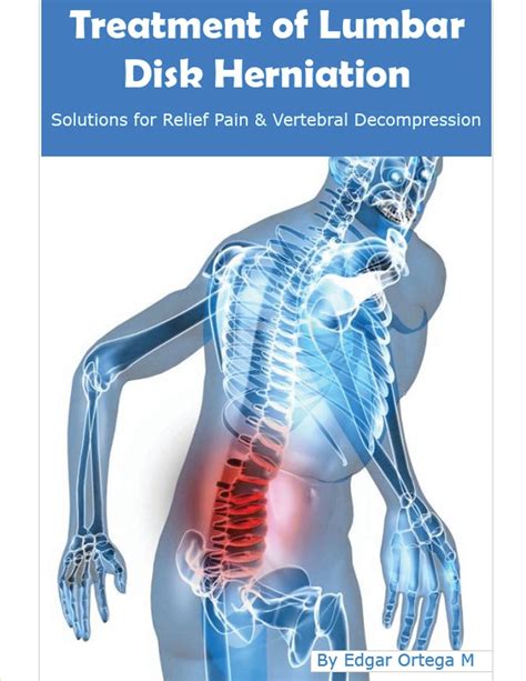 Buy Treatment Of Lumbar Disk Herniation Back Pain Relief And Herniated