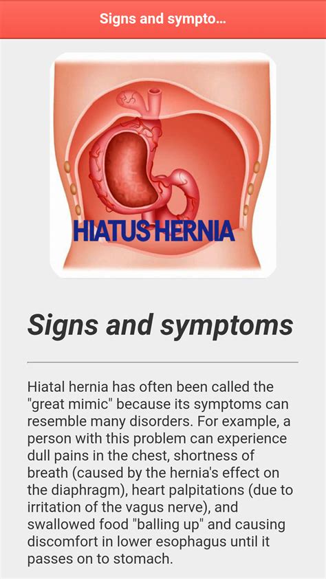 Hiatus Hernia Disease Uk Apps And Games