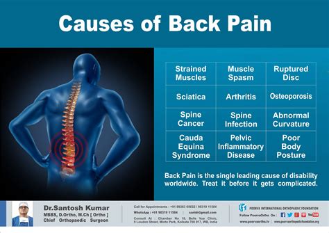Diagnose Back Pain Symptoms Chart