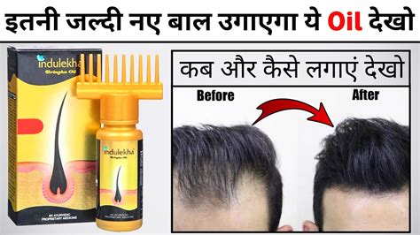 Indulekha Hair Oil Review Indulekha Hair Oil Results How To Use