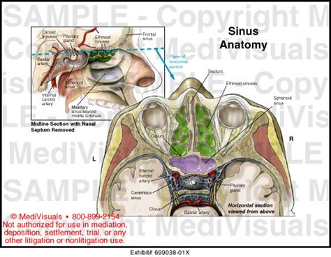 Medivisuals Sinus Anatomy Medical Illustration