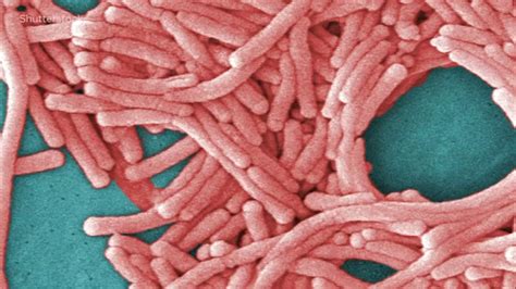 What Is Legionnaires Disease Everything You Need To Know About