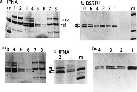 Figure 6 From Alterations Of The P16 Prb Pathway And The Chromosome