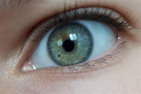 Green Blue Heterochromia R Eyes