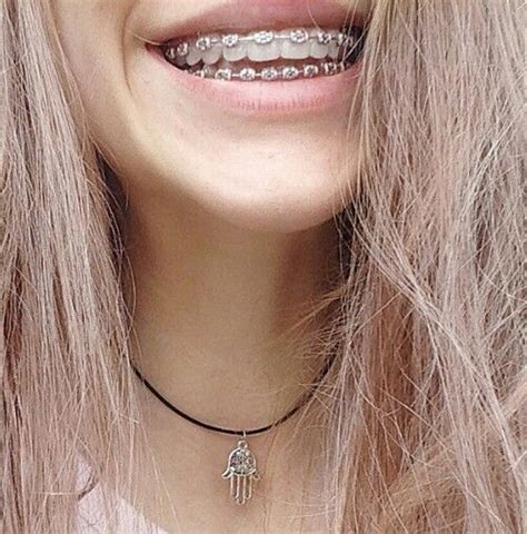 Perfect Teeth With Braces Tumblr