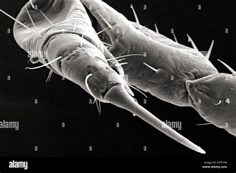 Microscopic Detail Female Body Louse S Foreleg Stock Photo Alamy