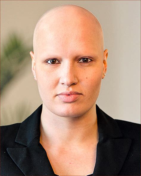 If you have it, there are. Vorher-Nachher Effekte - überzeugen Sie sich selbst