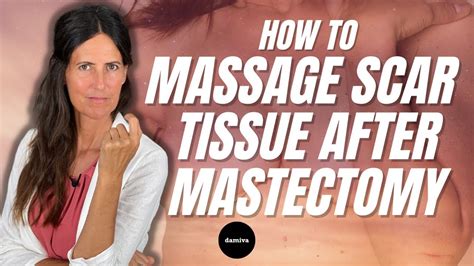How To Massage Your Scar Tissue After Mastectomy Youtube