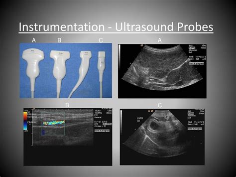 Ppt Introduction To Ultrasound Powerpoint Presentation Free Download