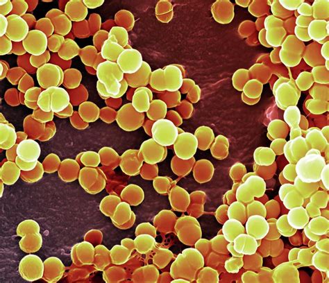 Mrsa Bacteria Photograph By Science Photo Library Fine Art America