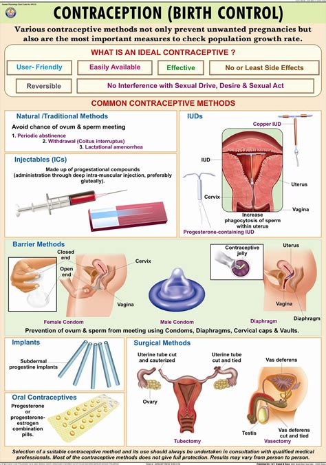 Contraceptive Methods Chart