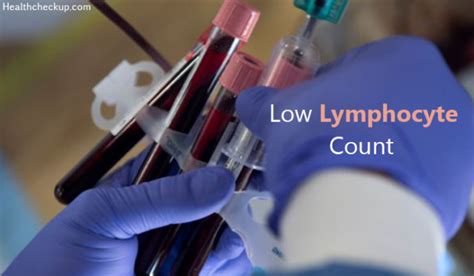 Low Lymphocyte Count Causes Symptoms Normal Ranges Treatment