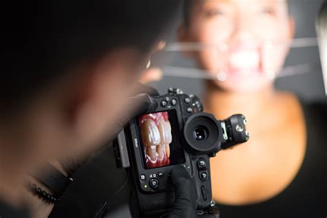 5 Reasons Why Dental Photography Is Important For Your Career