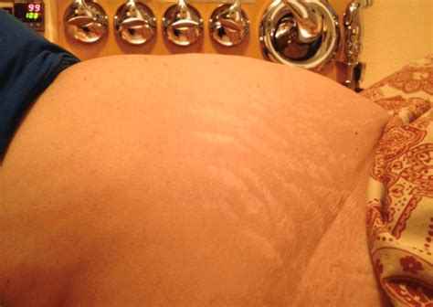 Colonic Hydrotherapy In Fort Smith Ar Gallery