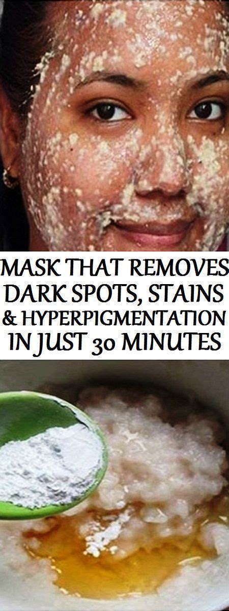 How To Remove Dark Spots Stains Naturally Here Is An