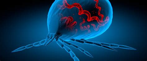 Borelioza Przyczyny Objawy Diagnostyka Leczenie Choroby Z Lyme