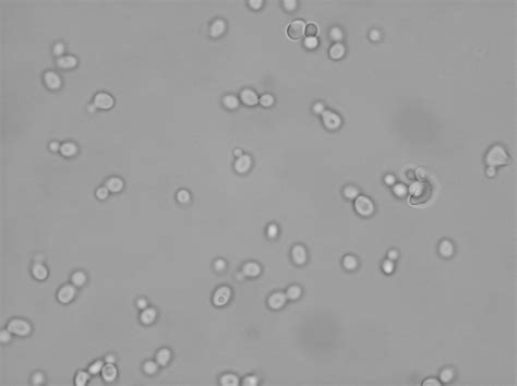 Budding Yeast Cell Under Microscope Micropedia