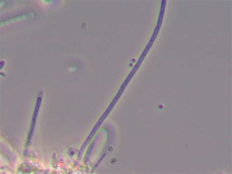 Has Anyone Seen This Filamentous Bacteria In Activated Sludge