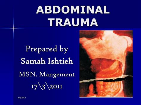 Ppt Abdominal Trauma Powerpoint Presentation Free Download Id637017