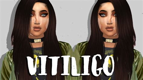 The Sims 4 Create A Sim Vitiligo Beauty Cc List