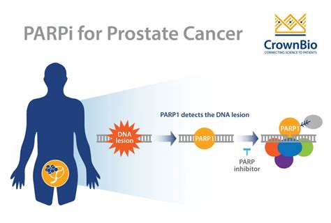 Parp Inhibitors In Prostate Cancer Treatment Crown Bioscience