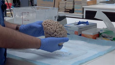 Brain Tissue Crucial In Understanding Autism Scitech Now