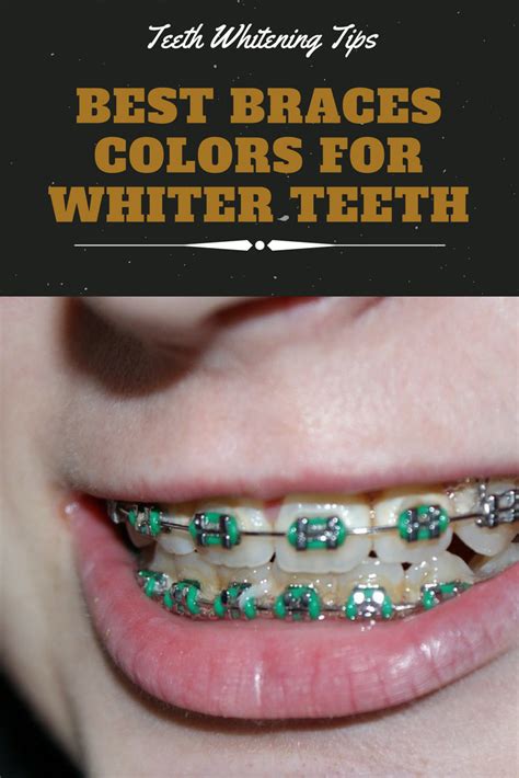 Incredible Best Braces Colors To Make Your Teeth Whiter Ideas